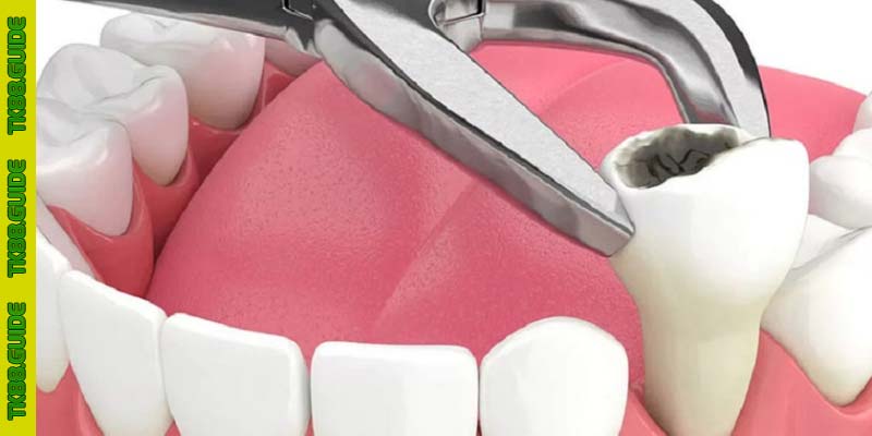 Giải Mã Giấc Mơ Thấy Bị Nhổ Răng